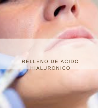 Relleno con Ácido Hialurónico en AnyLopez Benidorm