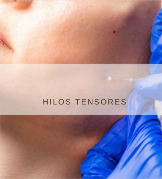 Hilos Tensores en AnyLopez Benidorm