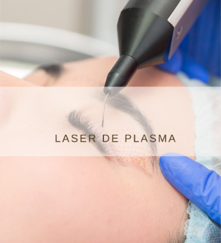 Láser de Plasma Pen