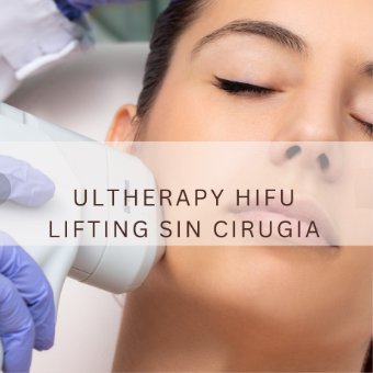 Ultherapy HIFU – Lifting sin Cirugía en AnyLopez Benidorm